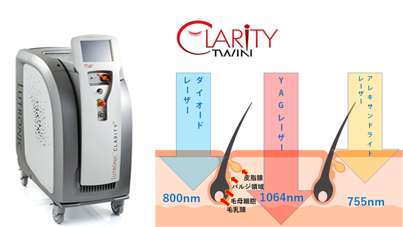 最新脱毛マシンクラリティ